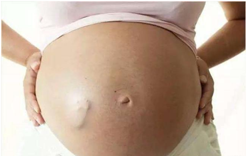 孕妈有这3种感觉，可能是胎儿在宫内不再生长，怀孕，别太粗心