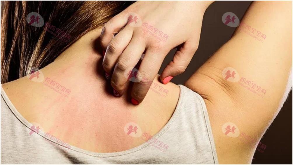 怀孕皮肤痒、皮肤变差、长痘痘，孕期皮肤常见五大症状对策