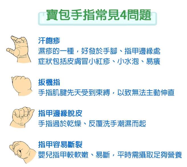 宝宝手指常见4大问题、症状、改善与保养方式