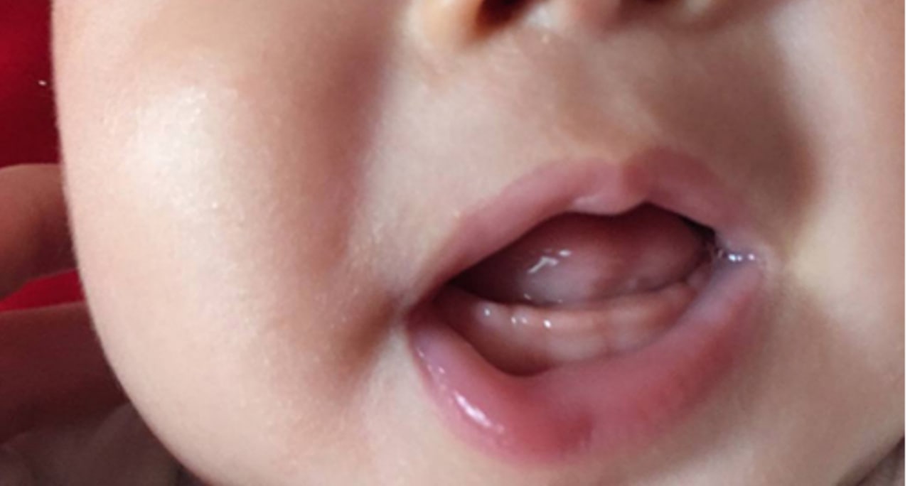 宝宝长牙期间的护理方法（宝宝长牙时间和顺序）