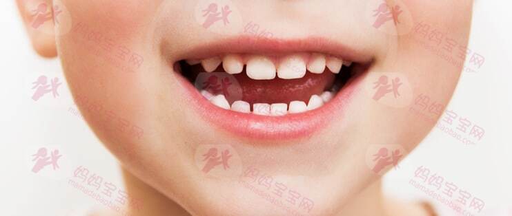 孩子长蛀牙之后的常见处理方法