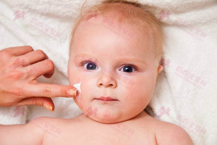 宝宝湿疹的诊断、护理与预防