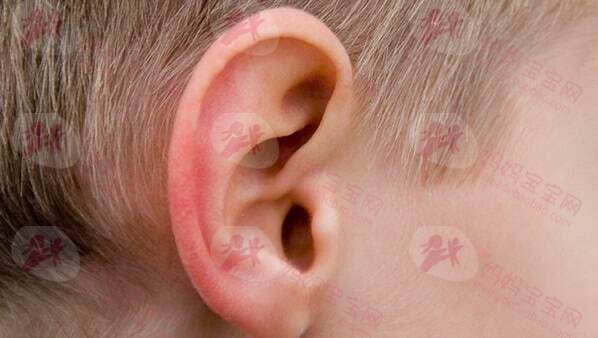 为什么感冒容易导致宝宝中耳炎？宝宝中耳炎怎么治疗和预防？