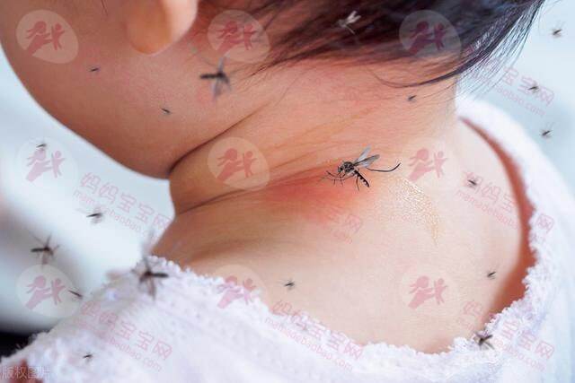 宝宝几个月可以用驱蚊剂？宝宝被蚊虫叮咬后怎么办？