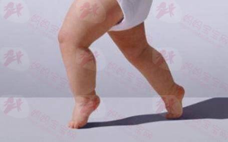 宝宝为什么会有O型腿？穿纸尿裤会导致O型腿吗？