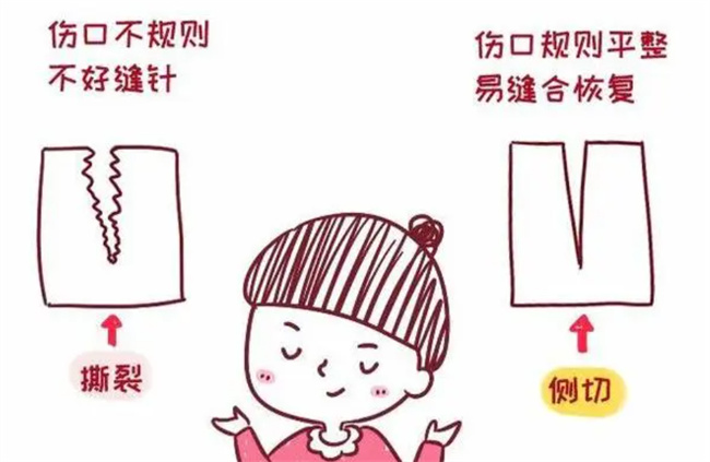 分娩的时候侧切和撕裂 哪个恢复的快（侧切）