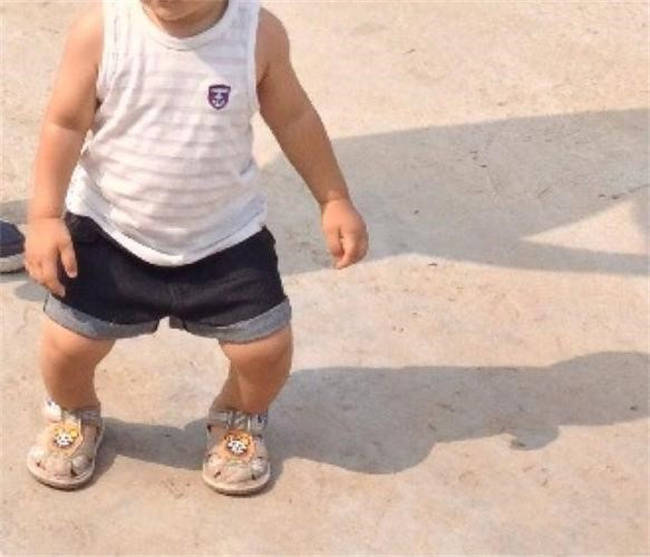 宝宝过早学会走路会导致腿部变形吗（会）