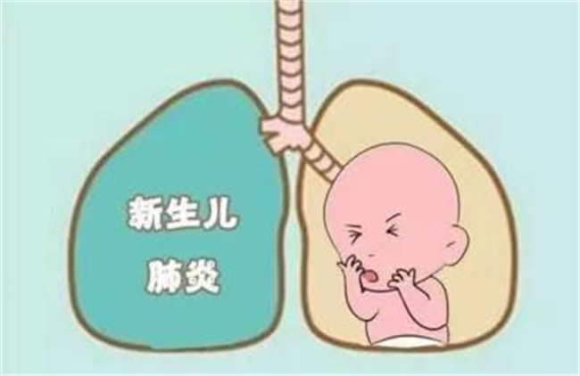 新生儿肺炎是什么原因