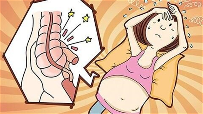 孕期阑尾炎有哪些症状（转移性右下腹疼痛等）
