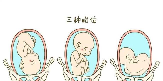 胎位不正孕妇需要注意哪些事项（定期产检，按照医生的指导操作，保持良好的