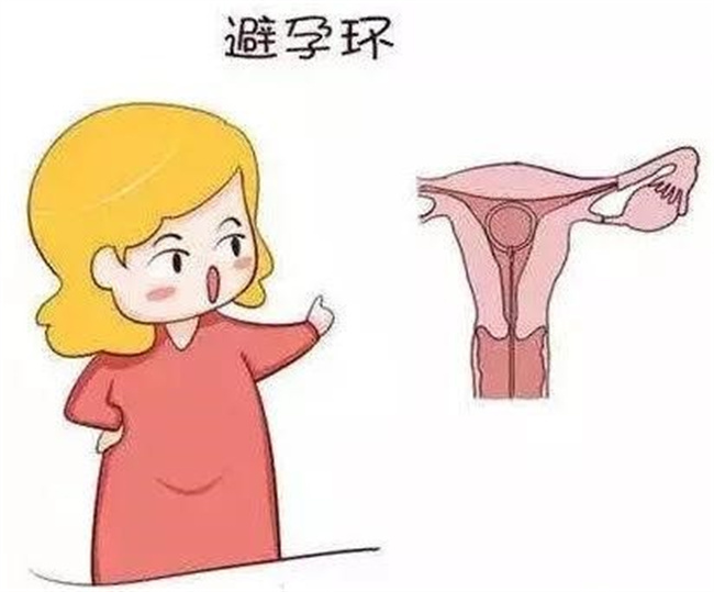取环以后没有避孕 一直不怀孕是什么原因（子宫内膜受损）