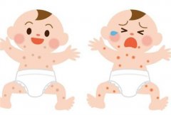 宝宝几种不同症状皮炎的护理措施