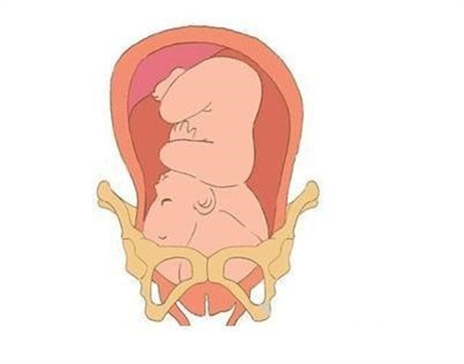 胎儿入盆后多久会生（4周以内）