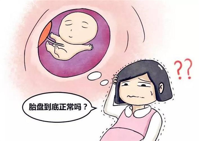 孕妈妈胎盘异常带来哪些不良后果（胎儿畸形发育等）