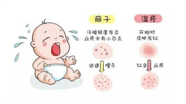 宝宝湿疹类型有哪些，湿疹该如何治疗（5种类型，及时就医）