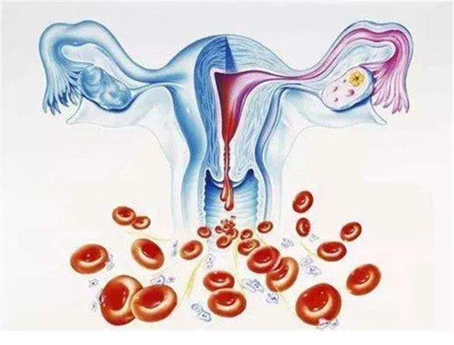 功能性子宫出血是怎么回事
