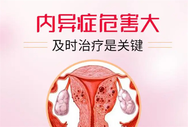子宫内膜异位的症状有哪些