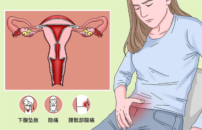 黄体囊肿对月经有影响吗