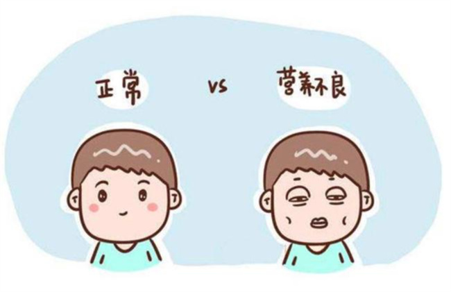 宝宝营养不良有哪些症状