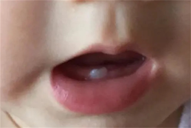宝宝一般几个月长牙