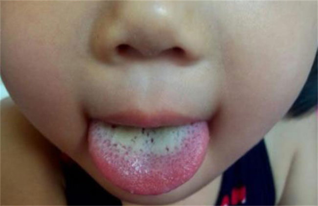 宝宝舌苔厚白的食疗方法