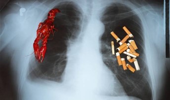 肺癌有哪些症状 会传染吗