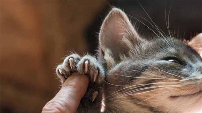 如何治疗猫抓病