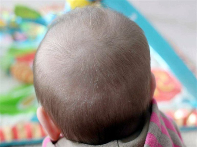 宝宝头发稀少是什么原因