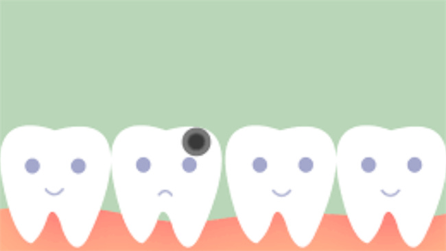 乳牙龋齿的危害有哪些