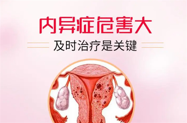 探索子宫内膜异位症的常见症状及表现