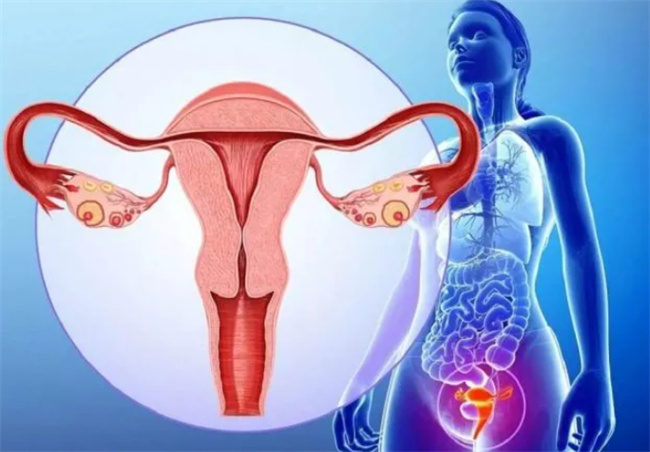 子宫肉瘤与子宫肌瘤的区别及特征解析