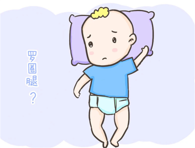 婴儿罗圈腿的症状和原因