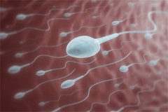 前列腺液中存在精子的情况