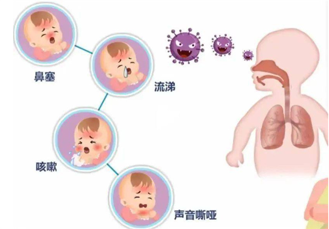 常发生的儿童5大呼吸管道病状
