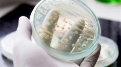 念球菌感染原因解析，如何预防？