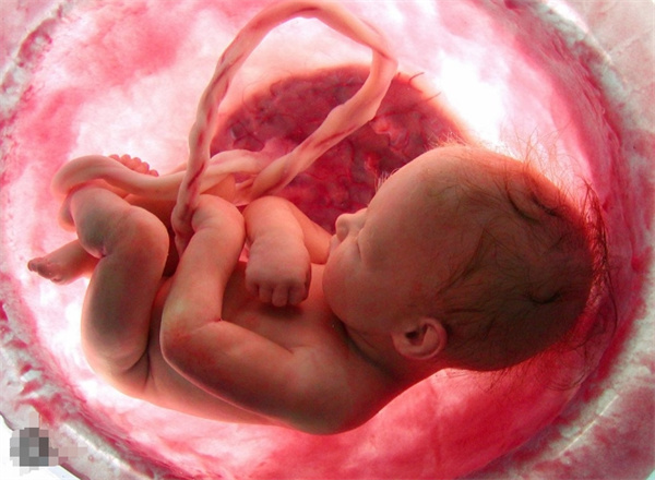 辨别胎儿性别：孕囊形状的可靠性评估