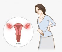 附件炎：女性常见的妇科疾病