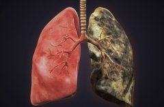 肺癌症状解析：咳血、胸痛和呼吸困难等表现