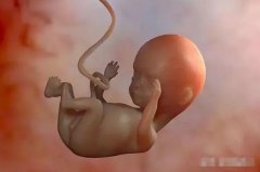 孕期假性宫缩及其处理方法