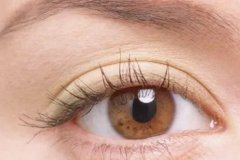 青光眼早期症状揭秘：如何及早察觉这一眼疾
