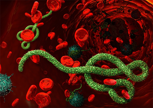 直播吧7月16日讯：埃博拉病毒感染引发关注，了解传播途径和预防措施是关键