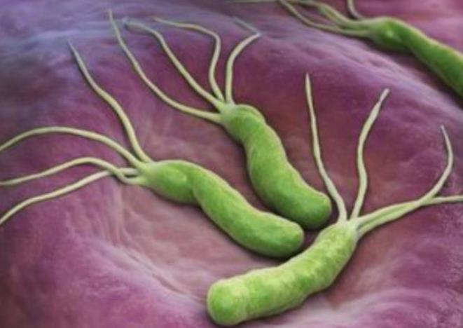 幽门螺旋杆菌感染：症状警示与早期治疗的重要性