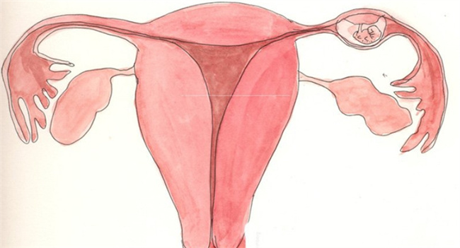 宫外孕危害女性健康，解析五大潜在原因与预防策略