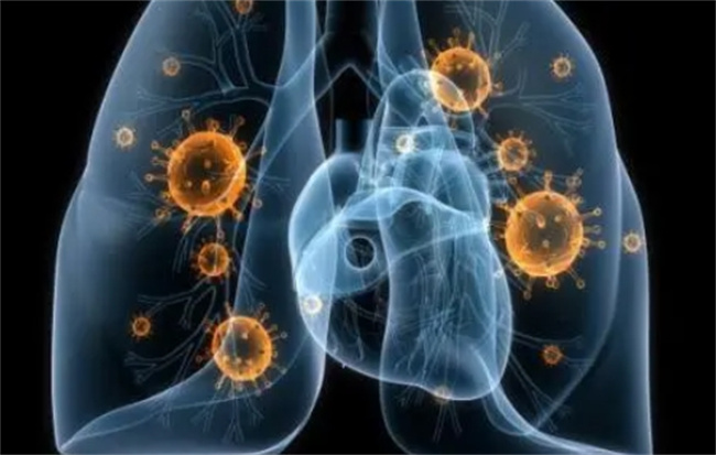 肺结核：不容忽视的传染病
