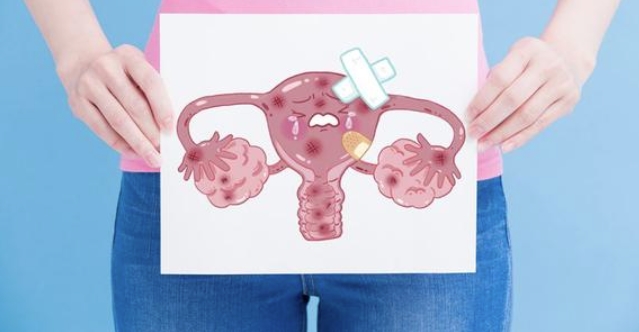 子宫肉瘤：治疗方法和预防措施
