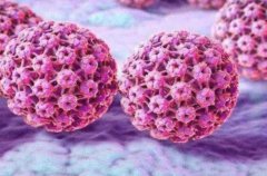 女性HPV早期症状及预防传播的关键知识