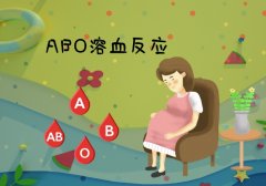 ABO溶血症：母婴血型不合引发的免疫性溶血