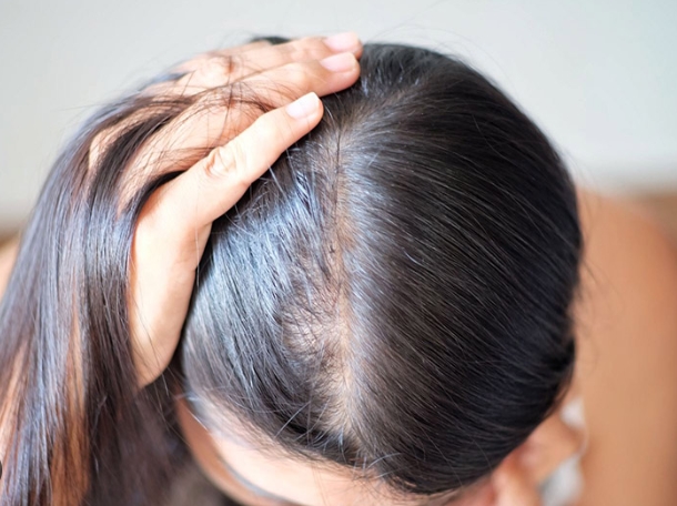 拯救秀发：头发稀少的原因及对策