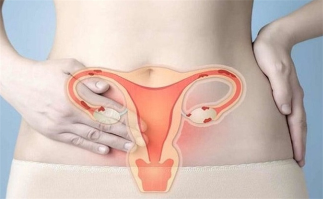 子宫寒冷：解析现代女性不容忽视的健康问题