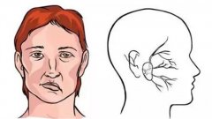 面部肌肉抽搐原因及应对方法详解